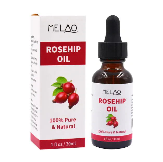 Rosehip Moisturizing Oil - 30ml